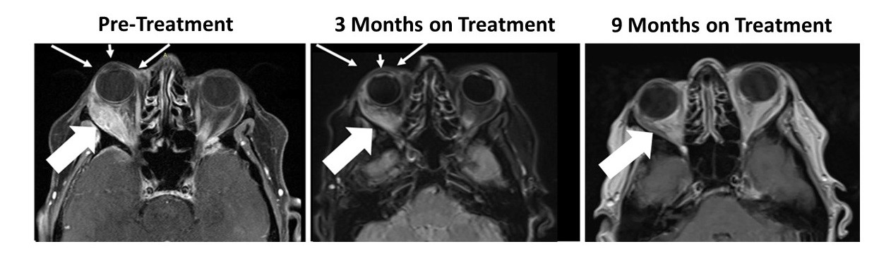 Figure 1: Responder Images - Bria-IMT™ Regimen